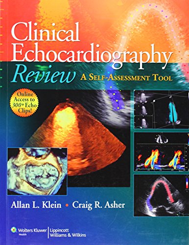 Clinical Echocardiography Review A Selfassessment Tool 1 Pappsc Allan L Klein Md Frcpc Facc Faha