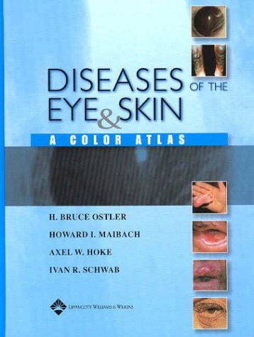 Diseases Of The Eye And Skin A Color Atlas 1st Edition H Bruce Ostler Md Deceased