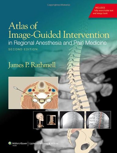 Atlas Of Imageguided Intervention In Regional Anesthesia And Pain Medicine Second James P Rathmell Md