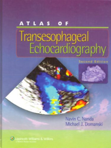 Atlas Of Transesophageal Echocardiography 2nd Navin C Nanda