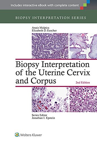 Biopsy Interpretation Of The Uterine Cervix And Corpus Second Anais Malpica Md