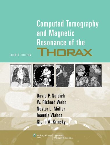 Computed Tomography And Magnetic Resonance Of The Thorax Fourth Monvadi B Srichai