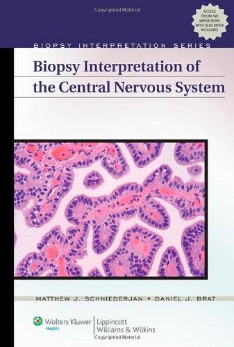 Biopsy Interpretation Of The Central Nervous System 1 Harpsc Matthew J Schniederjan Md