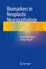 Biomarkers In Neoplastic Neuropathology 1st Edition Fausto Rodriguez