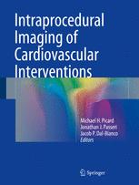 Intraprocedural Imaging Of Cardiovascular Interventions 1st Edition Michael H Picard