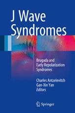 J Wave Syndromes Brugada And Early Repolarization Syndromes 1st Edition Charles Antzelevitch