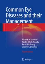 Common Eye Diseases And Their Management 4th Edition Nicholas R Galloway