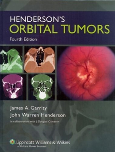 Hendersons Orbital Tumors 4th Edition James A Garrity John Warren Henderson