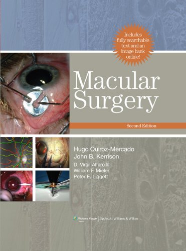 Macular Surgery 2nd Edition Hugo Quirozmercado Et Al