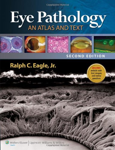 Eye Pathology An Atlas And Text Second Ralph C Eagle Md