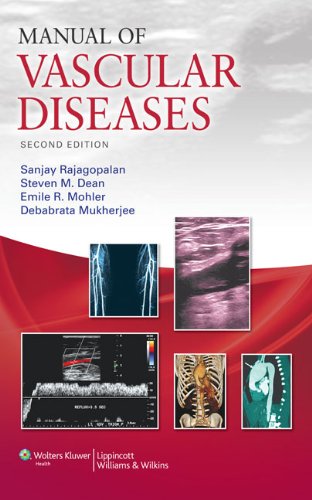 Manual Of Vascular Diseases Second Sanjay Rajagopalan Md Facc Faha