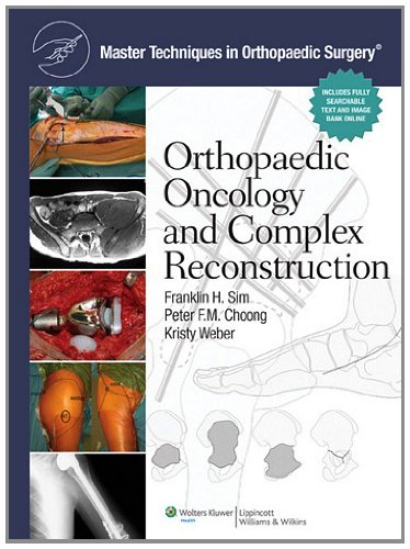 Master Techniques In Orthopaedic Surgery Orthopaedic Oncology And Complex Reconstruction 1 Harpsc Franklin H Sim Md