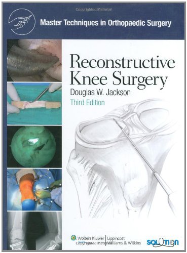 Reconstructive Knee Surgery Third Douglas W Jackson Md