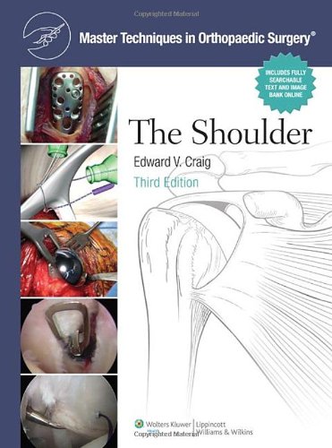 Master Techniques In Orthopaedic Surgery Shoulder Third Edward V Craig Md