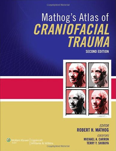 Mathogs Atlas Of Craniofacial Trauma Second Robert H Mathog Md