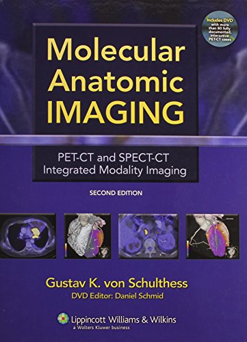 Molecular Anatomic Imaging Petct And Spectct Integrated Modality Imaging Second Gustav K Von Schulthess Md Phd