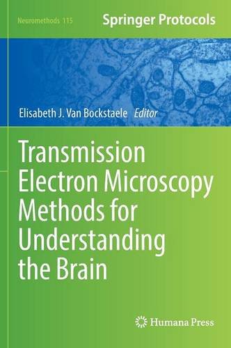 Transmission Electron Microscopy Methods For Understanding The Brain Elisabeth J Van Bockstaele