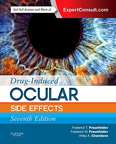 Druginduced Ocular Side Effects Clinical Ocular Toxicology 7th Edition Frederick T Fraunfelder