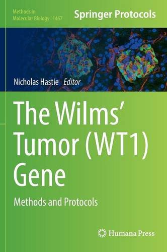 The Wilms Tumor Wt1 Gene Methods And Protocols Nicholas Hastie