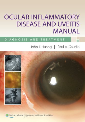 Ocular Inflammatory Disease And Uveitis Manual Diagnosis And Treatment 1st Edition John J Huang Md