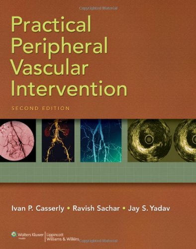 Practical Peripheral Vascular Intervention Second Ivan P Casserly Mb Bch
