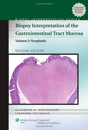 Biopsy Interpretation Of The Gastrointestinal Tract Mucosa Volume 2 Neoplastic Second Elizabeth A Montgomery Md