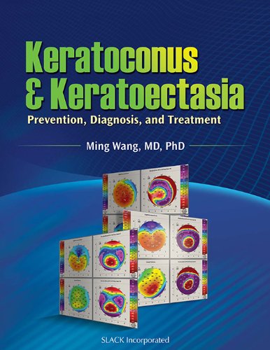 Keratoconus And Keratoectasia Prevention Diagnosis And Treatment 1st Edition Ming Wang Md