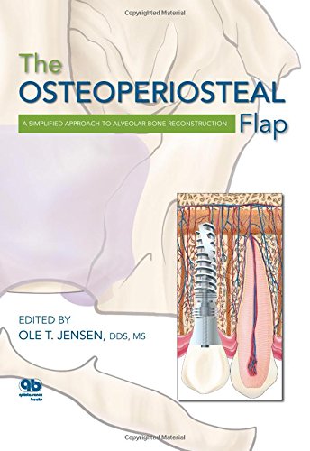 The Osteoperiosteal Flap A Simplified Approach To Alveolar Bone Reconstruction 1st Edition Ole T Jensen
