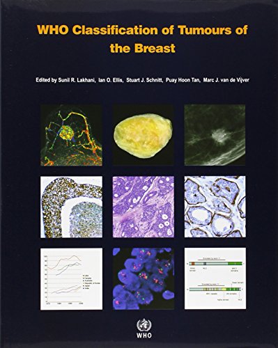 Who Classification Of Tumours Of The Breast 4th Edition International Agency For Research On Cancer
