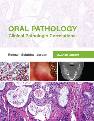 Oral Pathology Clinical Pathologic Correlations 7th Edition Joseph A Regezi