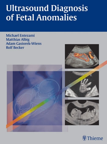 Ultrasound Diagnosis Of Fetal Anomalies 1st Edition Michael Entezami
