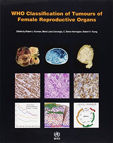 Who Classification Of Tumours Of The Female Reproductive Organs 4th Edition International Agency For Research On Cancer