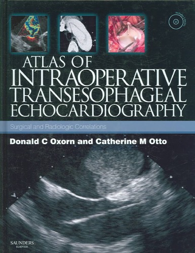 Atlas Of Intraoperative Transesophageal Echocardiography 1st Edition Donald C Oxorn