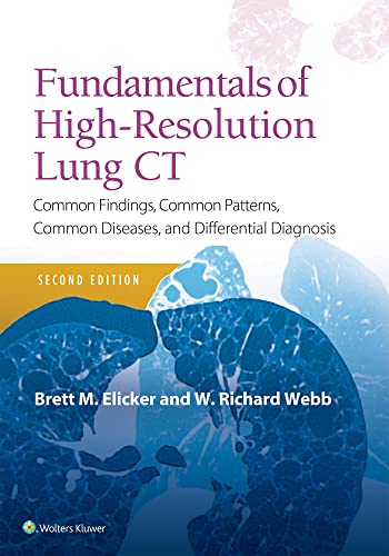 Fundamentals Of Highresolution Lung Ctcommon Findings Common Patterns Common Diseases And Differential Diagnosis 2nd Edition Elicker Md