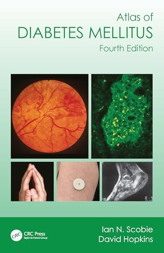 Atlas Of Diabetes Mellitus 4e Dec 29 20231032379456crc Press 4th Edition Scobie