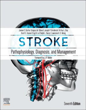 Stroke Pathophysiology Diagnosis And Management 7e 2021 7th Edition James Grotta