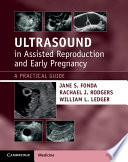 Ultrasound In Assisted Reproduction And Early Pregnancy A Practical Guide 1st Edition Jane S Fonda