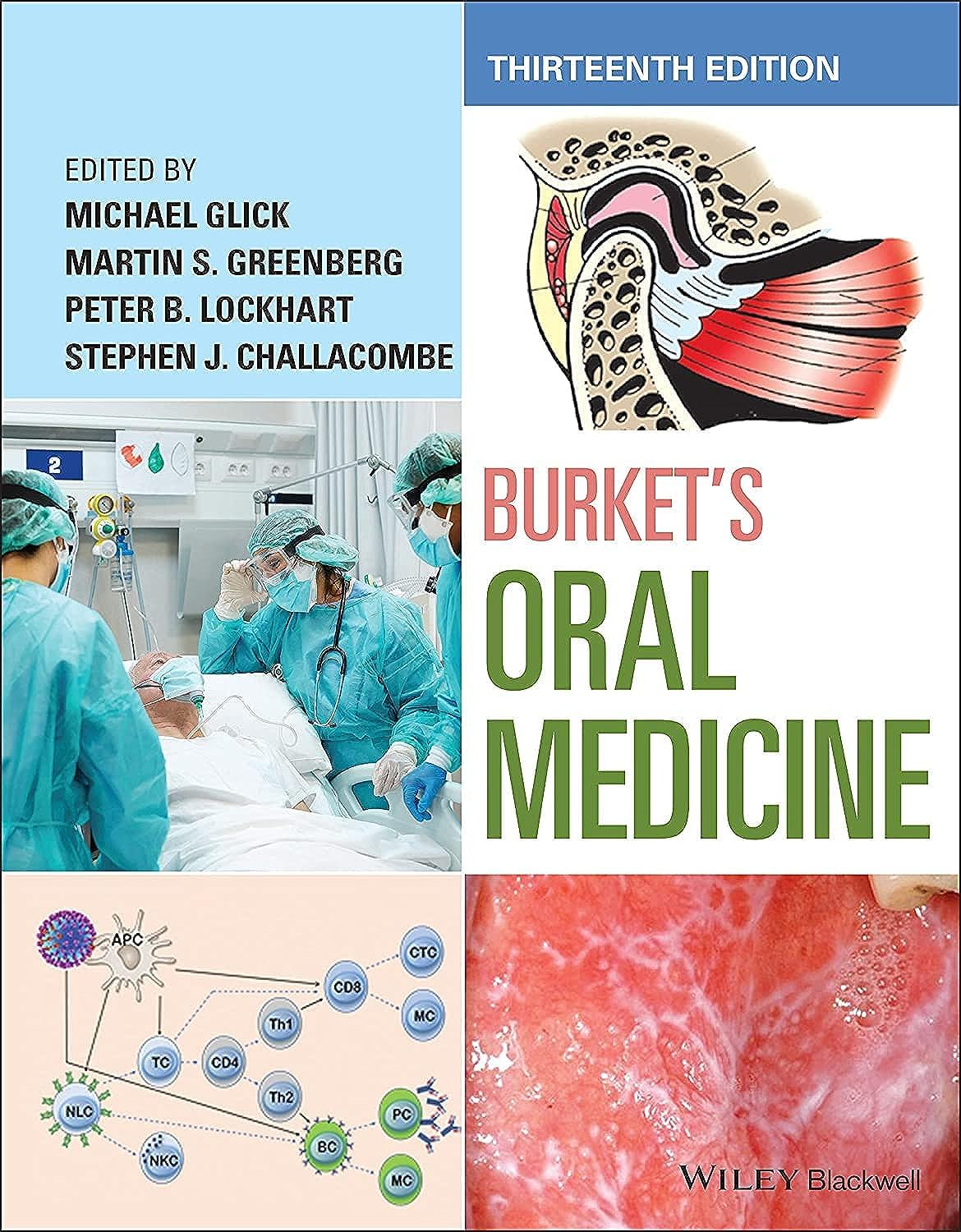 Burkets Oral Medicine 13th Michael Glick Martin S Greenberg