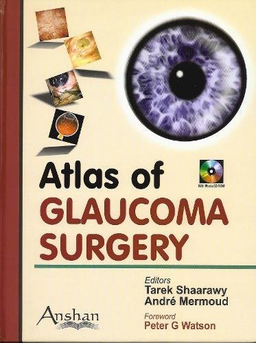 Atlas Of Glaucoma Surgery Bkcdrom Tarek Shaarawy