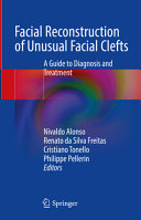 Facial Reconstruction Of Unusual Facial Clefts Nivaldo Alonso