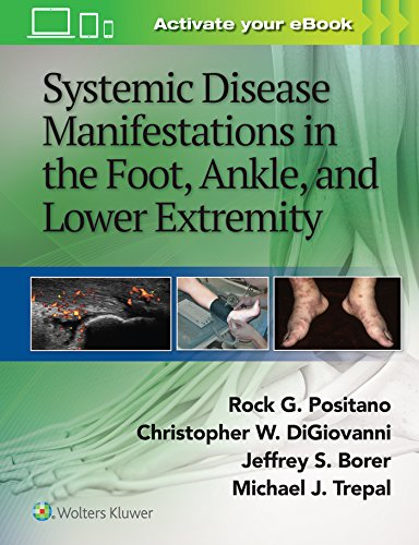 Systemic Disease Manifestations In The Foot Ankle And Lower Extremity May 25 20171451192649lww First Edition Rock G Positano