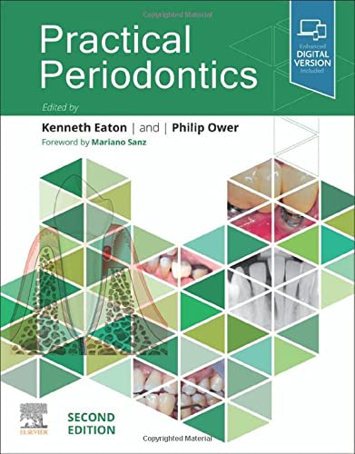 Practical Periodontics 2nd Edition 2nd Ken A Eaton Philip Ower