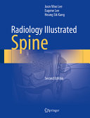 Radiology Illustrated Spine 2nd Edition 2nd Joon Woo Lee Eugene Lee