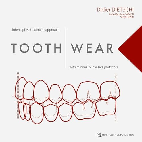 Tooth Wear Interceptive Treatment Approach With Minimally Invasive Protocols 1st Edition Dietschi