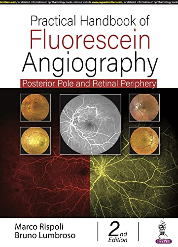 Practical Handbook Of Fluorescein Angiography Posterior Pole And Retinal Periphery 2nd Edition 2nd Rispoli