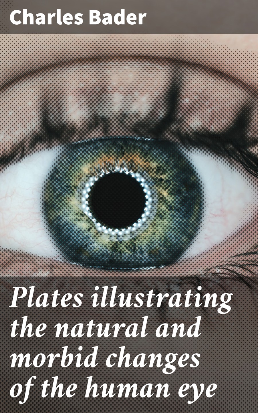 Plates Illustrating The Natural And Morbid Changes Of The Human Eye Charles Bader