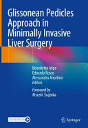 Glissonean Pedicles Approach In Minimally Invasive Liver Surgery Benedetto Ielpo