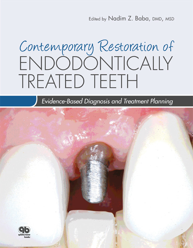 Contemporary Restoration Of Endodontically Treated Teeth Nadim Z Baba