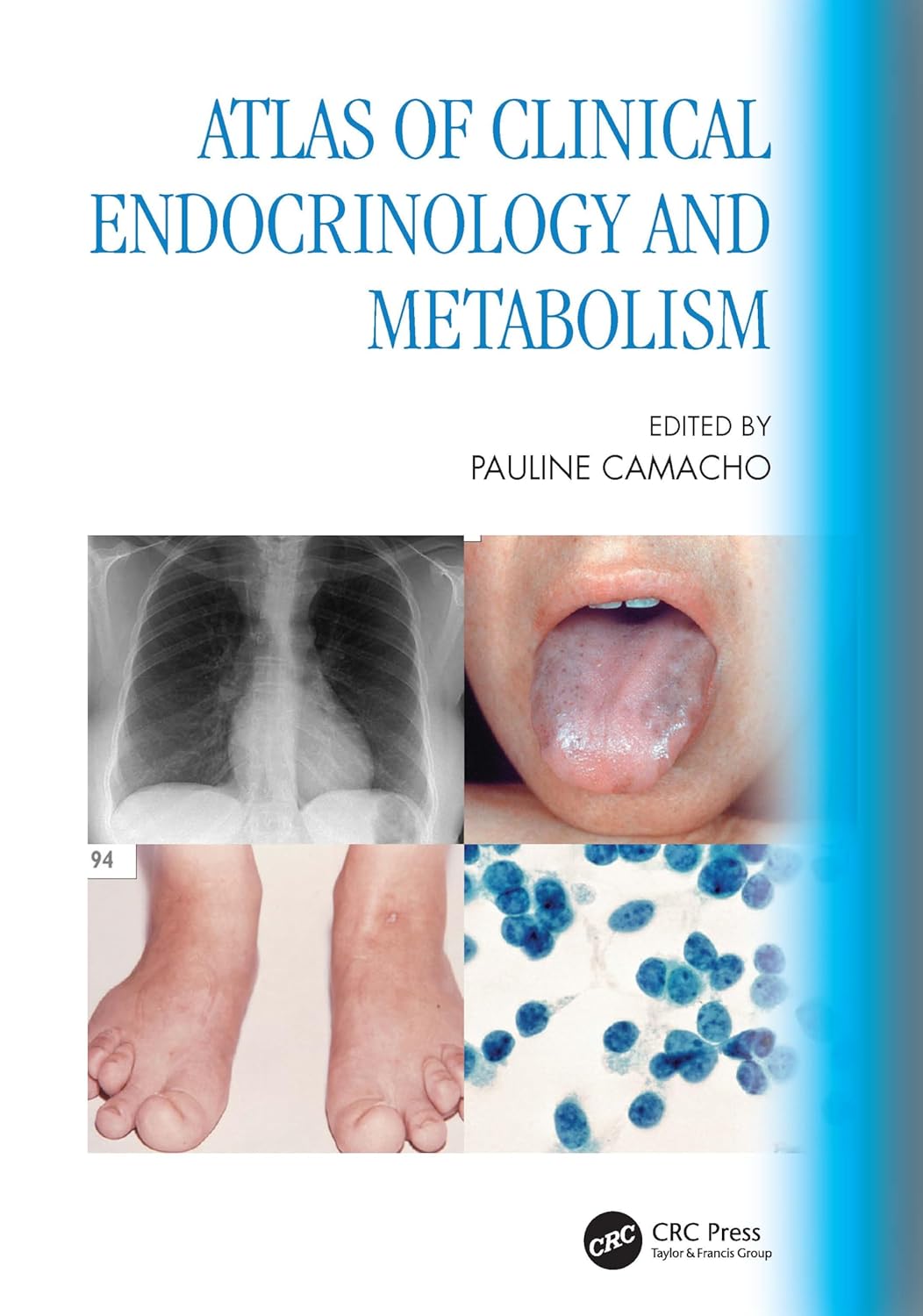 Atlas Of Clinical Endocrinology And Metabolism 1st Edition Pauline Camacho