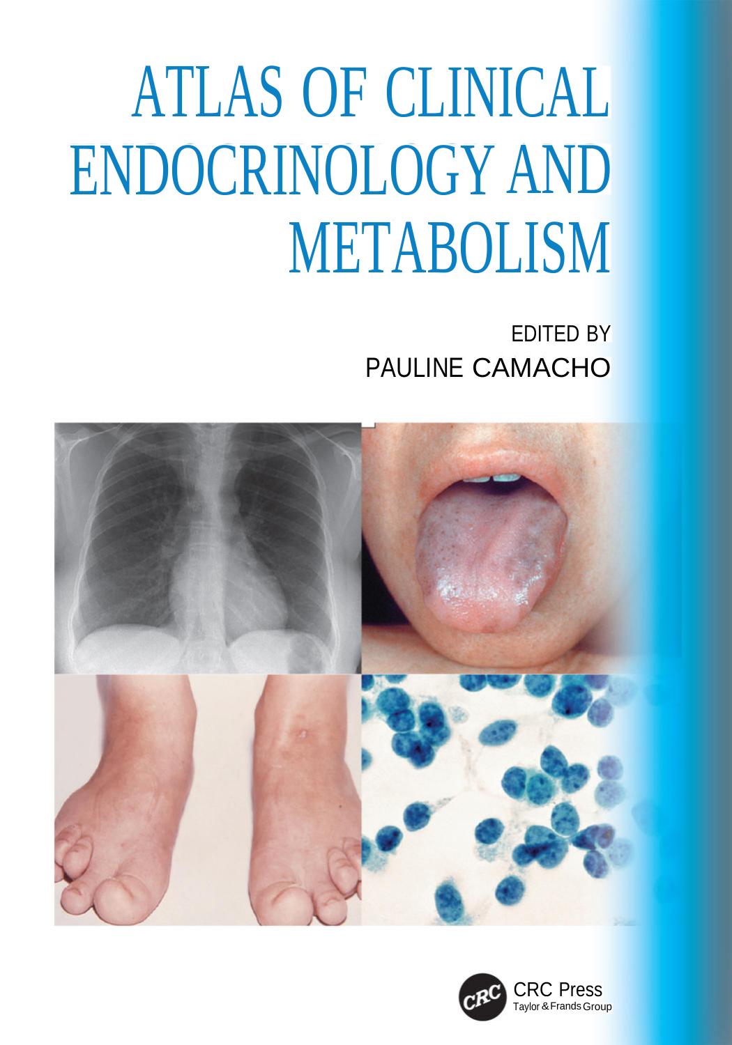 Atlas Of Clinical Endocrinology And Metabolism Feb 16 20240367608359crc Press Edited By Pauline Camacho